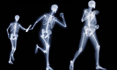 Read more about the article BONE diseases, emotional and spiritual meaning: