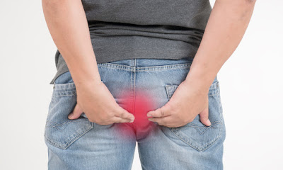 Read more about the article HEMORRHOIDS, emotional and spiritual meaning