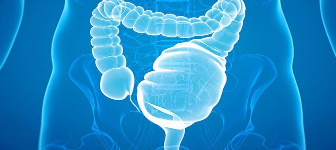 ulcerative-colitis-722x406_1160x520