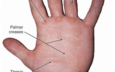 METACARPAL BONE OF THE INDEX FINGER