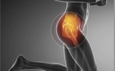 Trochanteric Bursitis: Emotional and Spiritual Meaning